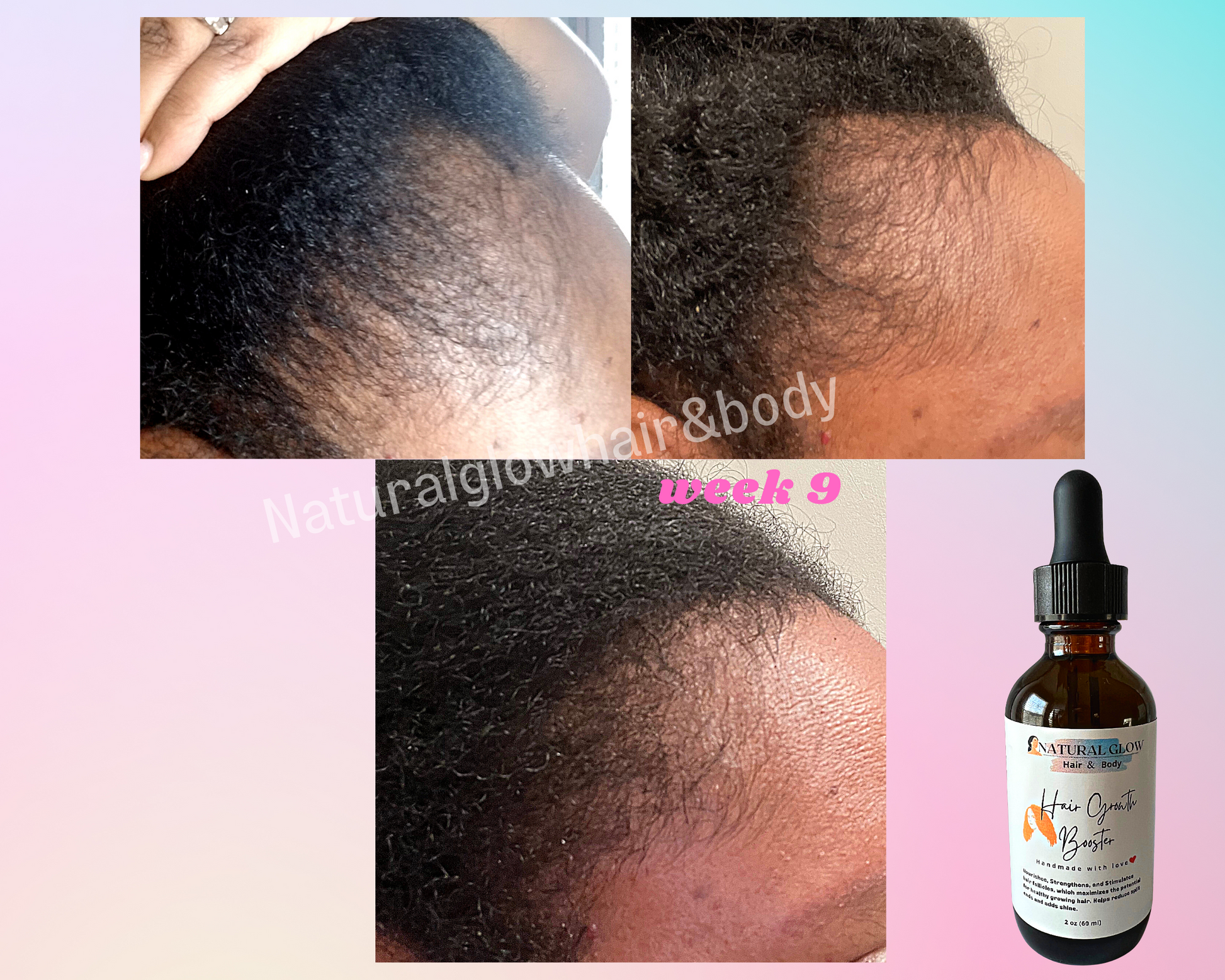 Hair Growth treatment