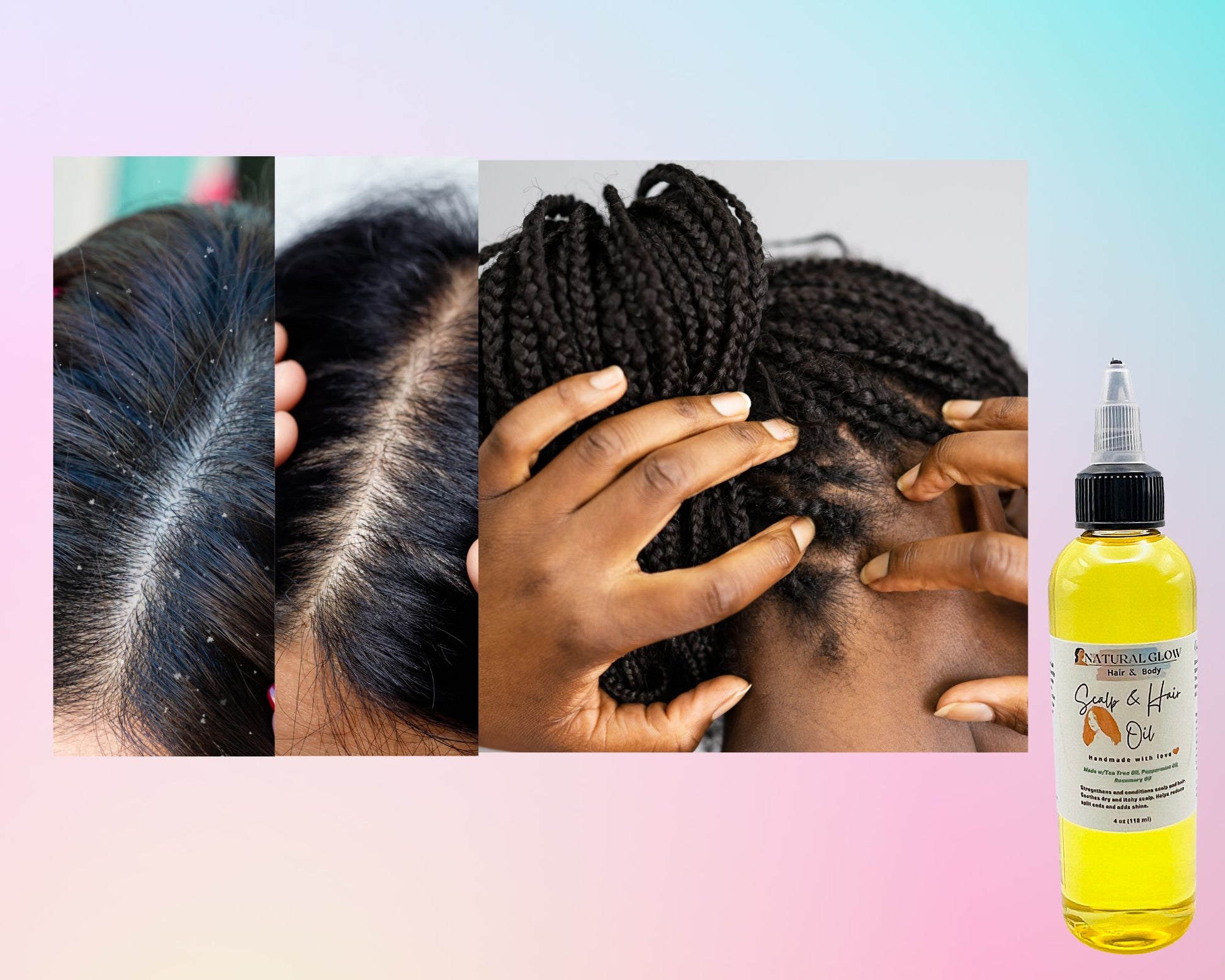 flaky scalp treatment